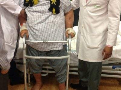 AFTER 2 YEARS PATIENT MADE TO STAND