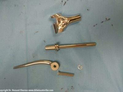 Elbow replacement components