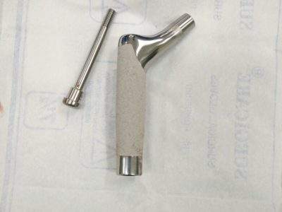 Restoration proximal femoral sleeve used in complex hip replacement