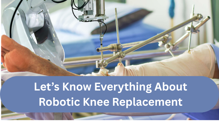 Robotic Knee Replacement