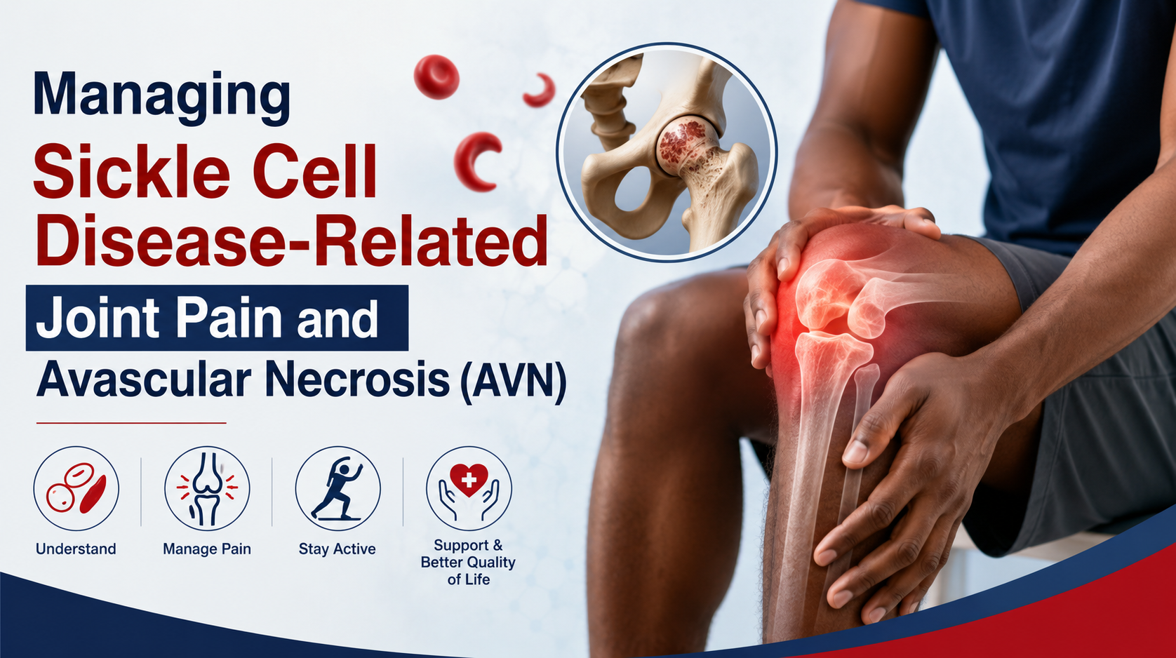 Managing Sickle Cell Disease-Related Joint Pain and Avascular Necrosis (AVN).
